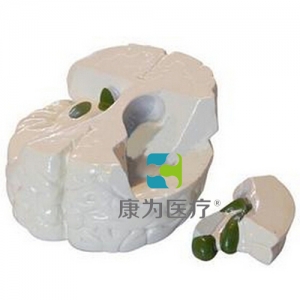 “康為醫(yī)療”海馬、穹隆、前連合模型