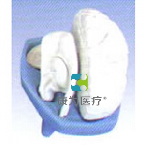 “康為醫(yī)療”內(nèi)囊位置、組成及分布模型