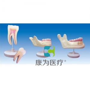 “康為醫(yī)療”磨牙、乳牙、橫牙解剖(自然大)