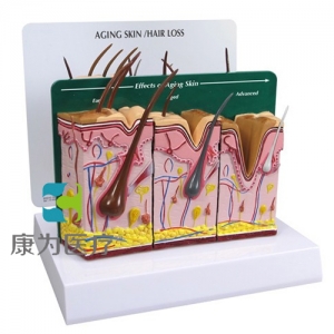 “康為醫(yī)療”醫(yī)患關(guān)系溝通模型-老化皮膚、脫發(fā)及正常皮膚（醫(yī)學(xué)指導(dǎo)模型）