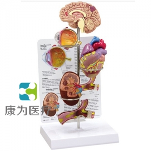 “康為醫(yī)療”醫(yī)患關(guān)系溝通模型-微型腦、眼、心、腎及動(dòng)脈模型 （醫(yī)學(xué)指導(dǎo)模型）