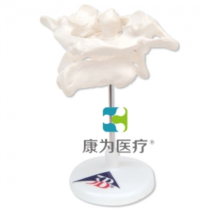 環(huán)椎和樞椎組合，置于可拆卸基架