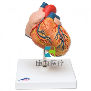 經(jīng)典心臟模型，呈左心室肥大，2部分