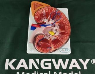 “康為醫(yī)療”腎臟解剖放大模型(放大3倍)