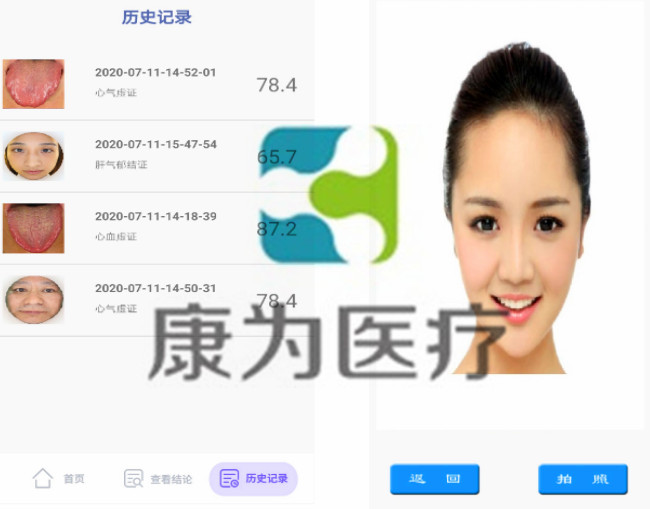 KANGWAY云中醫(yī)智能鏡生產(chǎn)廠家 KANGWAY云中醫(yī)智能鏡生產(chǎn)廠家