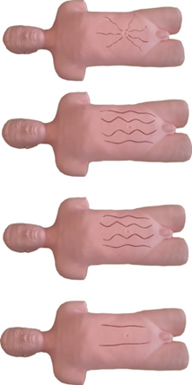 全自動(dòng)腹壁靜脈血流方向檢查技能訓(xùn)練標(biāo)準(zhǔn)化病人 全自動(dòng)腹壁靜脈血流方向檢查技能訓(xùn)練標(biāo)準(zhǔn)化病人