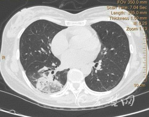 1660025303311451.jpg 2.jpg