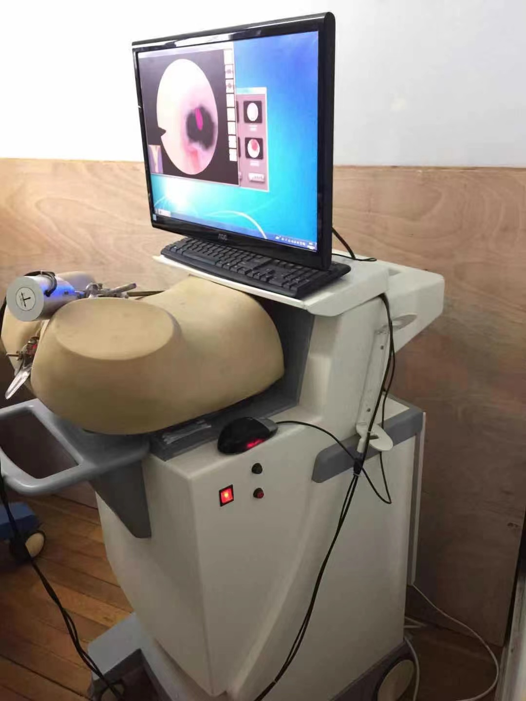 1683186111682725.png 宮腔鏡.png